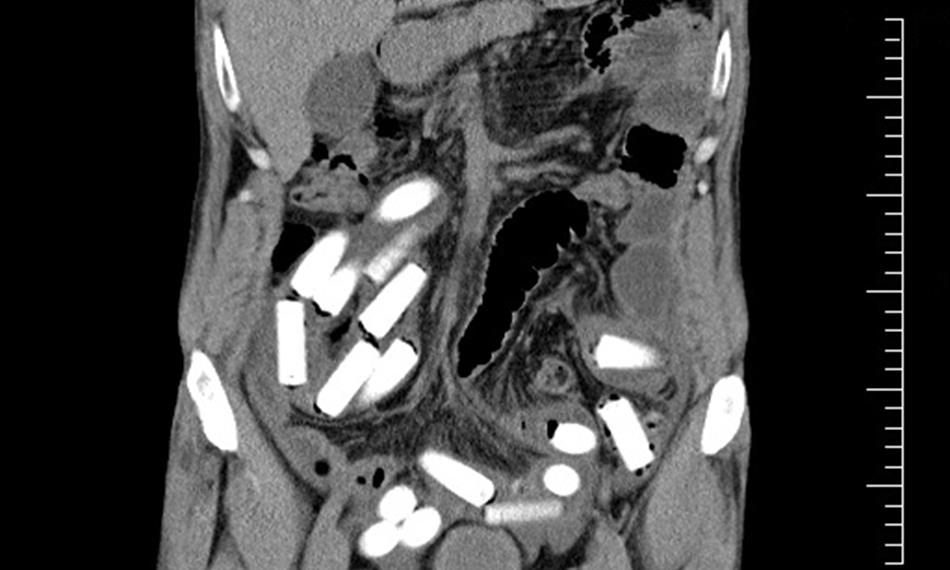 2011-10-20-1345 kokain  22.jpg